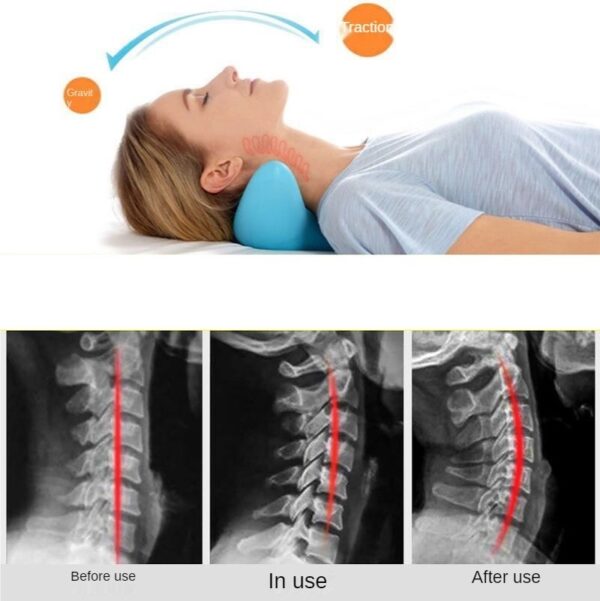 Cervical Spine Massage Pillow Gravity Acupressure Neck Massager Cervical Spine Pillow Neck Shoulder Massage Pillow Home Traction Corrector - Image 2